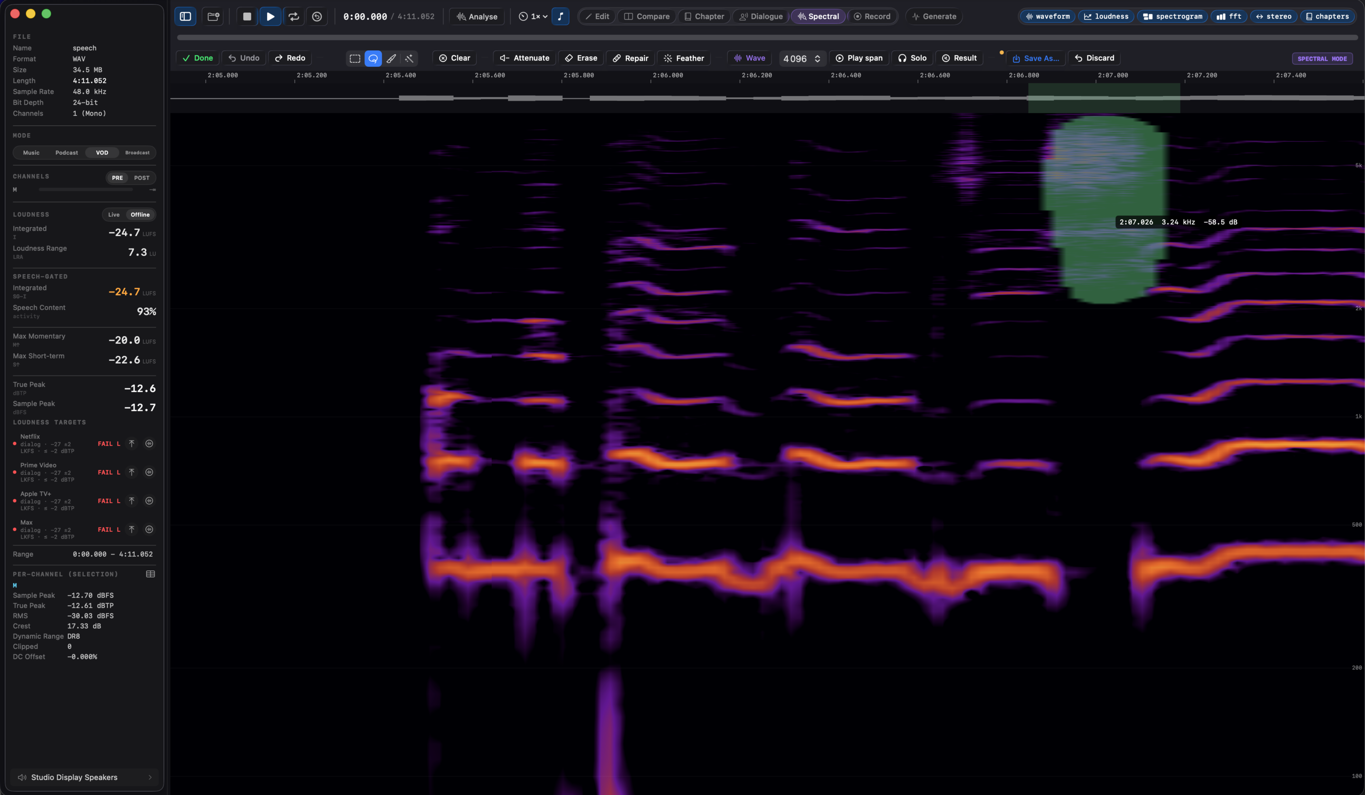 Specula's Spectral mode with a stereo file in the stacked Both view: a lasso selection drawn around a blemish in one channel's spectrogram, under the time ruler and waveform strip, with a frequency scale on the right and the violet spectral toolbar showing the four selection tools.