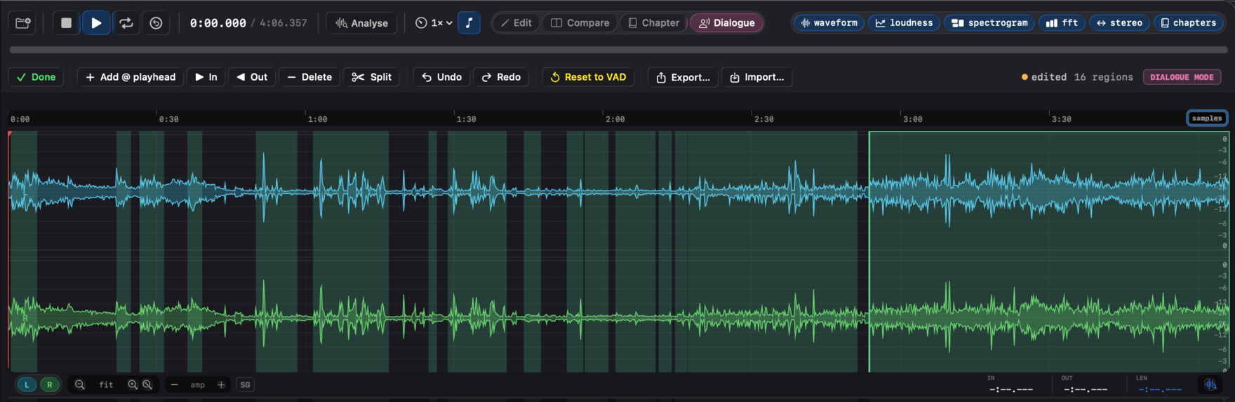 Waveform with the speech-gating toggle on and speech blocks shaded teal.